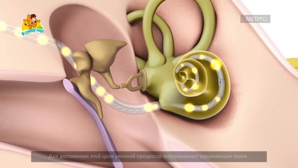 Сүйлөө процессорлорун сатып алууга 30 млн сом жумшалат